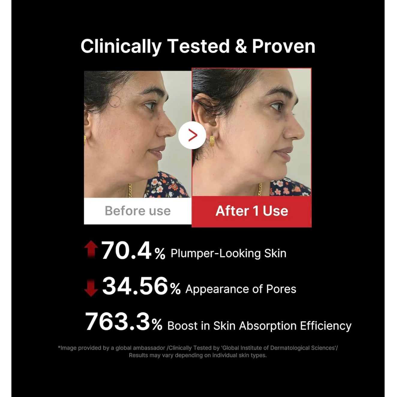 AGE-R Booster Pro.